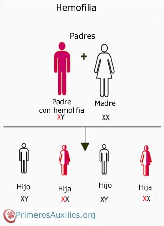 Definición de qué es hemofilia