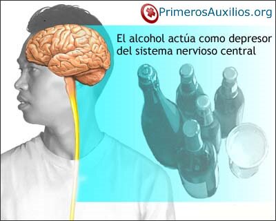 Efectos del consumo de alcohol