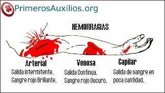 Definición y síntomas de hemorragia