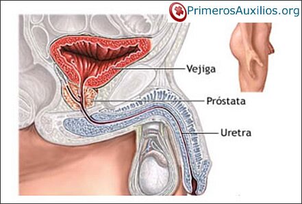 Importancia de los problemas de próstata